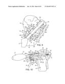 External Tibial Mill Guide and Method of Use diagram and image