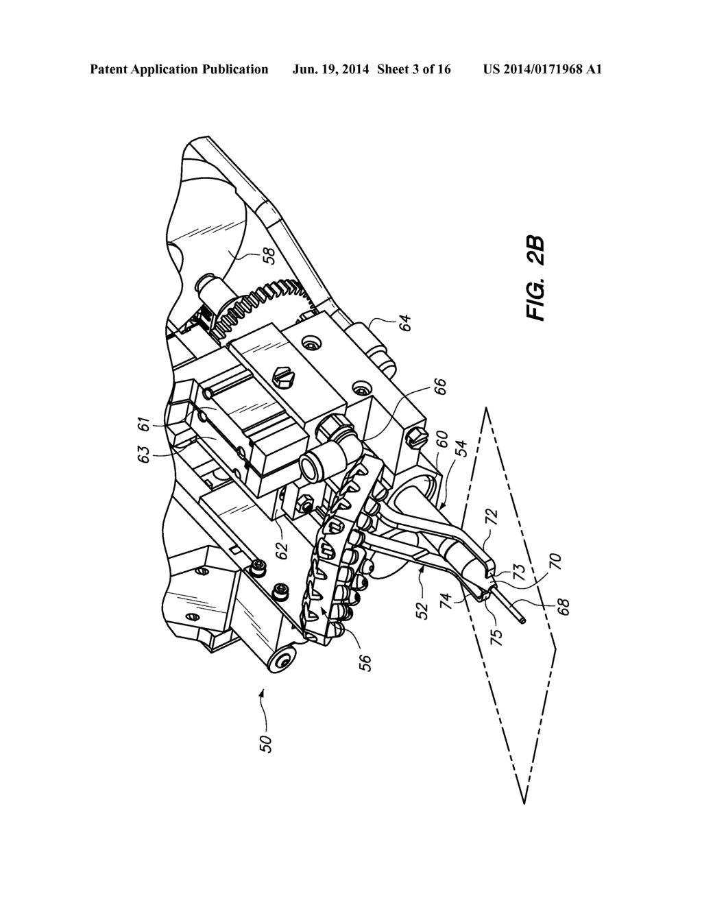 Follicular Unit Harvesting Tools for Severing Connective Tissue and     Methods of Their Use - diagram, schematic, and image 04