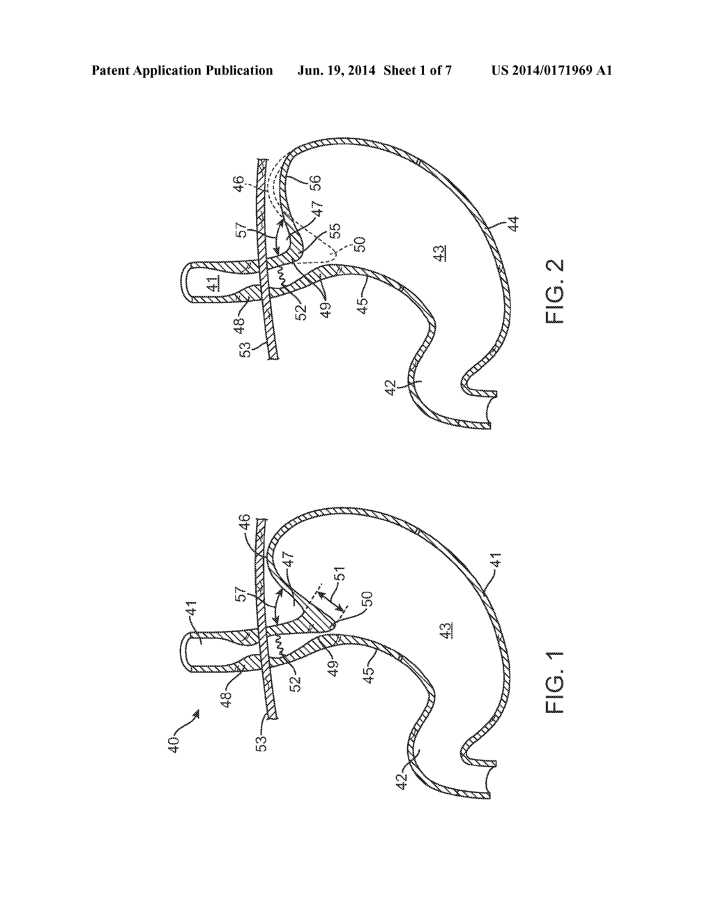 APPARATUS AND METHOD FOR CONCURRENTLY FORMING A GASTROESOPHAGEAL VALVE AND     TIGHTENING THE LOWER ESOPHAGEAL SPHINCTER - diagram, schematic, and image 02
