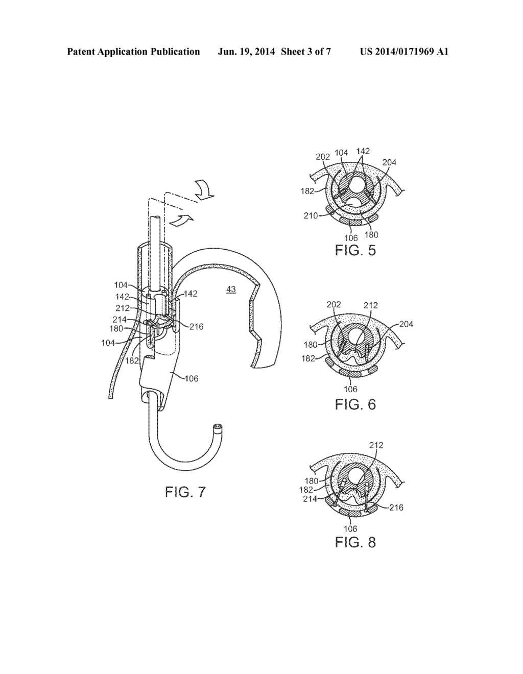 APPARATUS AND METHOD FOR CONCURRENTLY FORMING A GASTROESOPHAGEAL VALVE AND     TIGHTENING THE LOWER ESOPHAGEAL SPHINCTER - diagram, schematic, and image 04