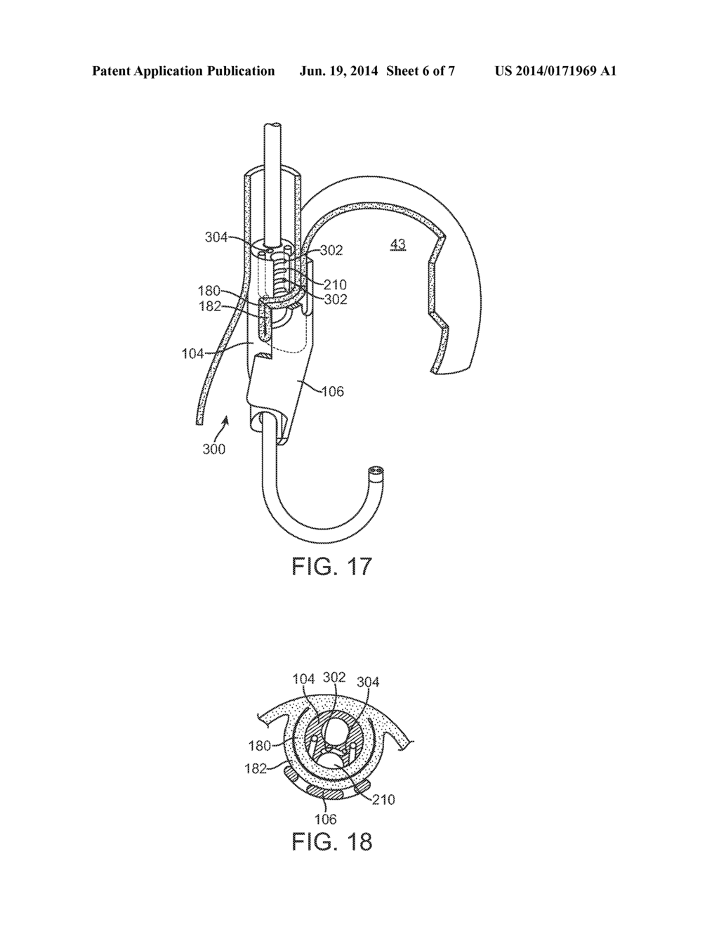 APPARATUS AND METHOD FOR CONCURRENTLY FORMING A GASTROESOPHAGEAL VALVE AND     TIGHTENING THE LOWER ESOPHAGEAL SPHINCTER - diagram, schematic, and image 07