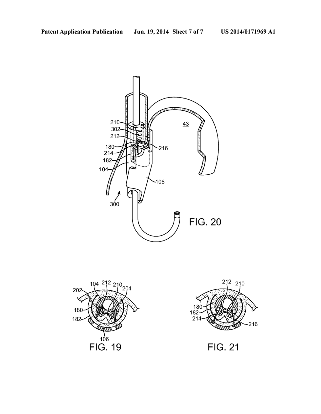APPARATUS AND METHOD FOR CONCURRENTLY FORMING A GASTROESOPHAGEAL VALVE AND     TIGHTENING THE LOWER ESOPHAGEAL SPHINCTER - diagram, schematic, and image 08