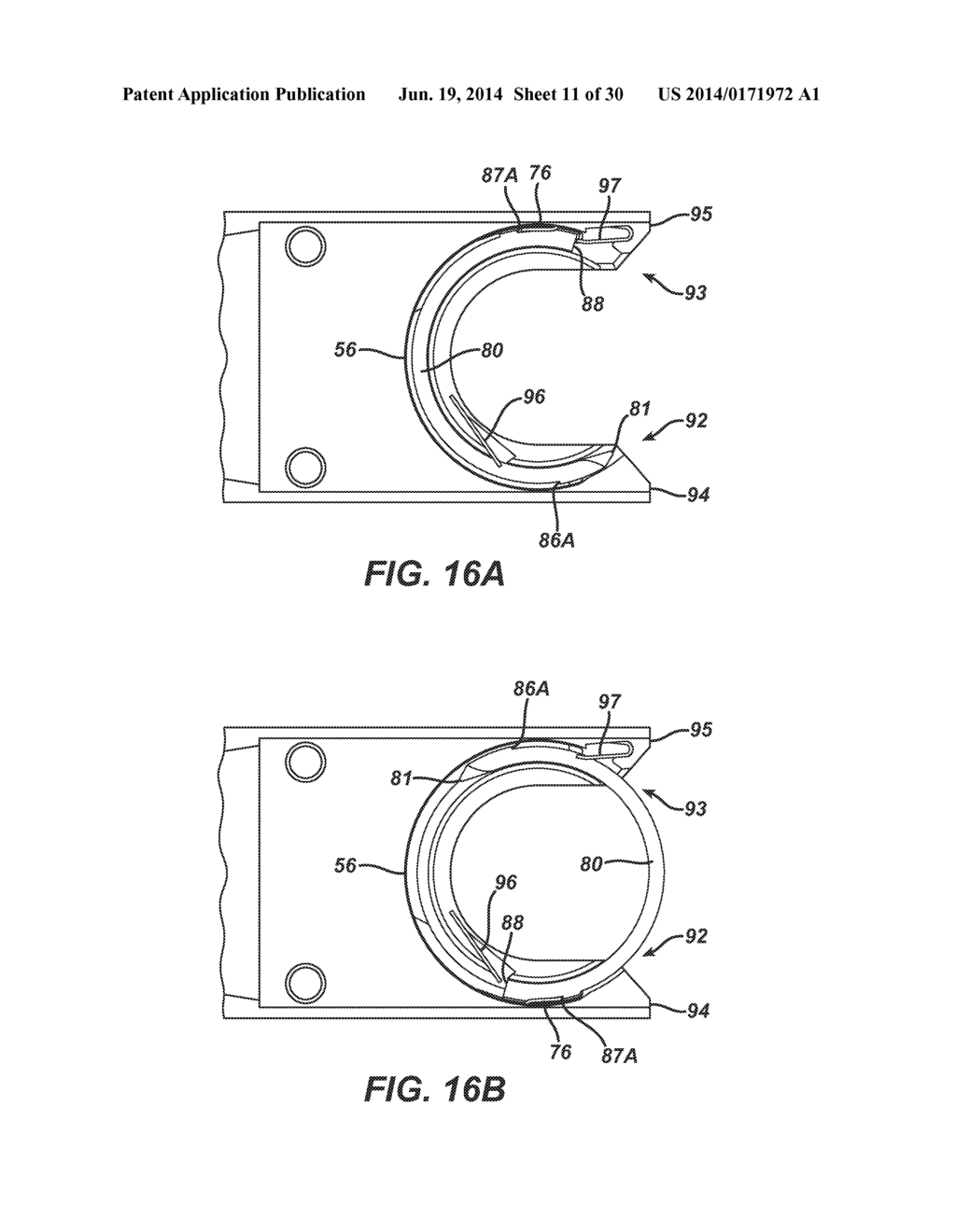 Circular Needle Applier with Offset Needle and Carrier Tracks - diagram, schematic, and image 12