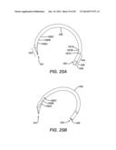 Circular Needle Applier with Offset Needle and Carrier Tracks diagram and image