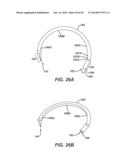 Circular Needle Applier with Offset Needle and Carrier Tracks diagram and image