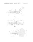 LIVING TISSUE LIGATION DEVICE diagram and image