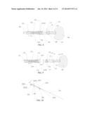 LIVING TISSUE LIGATION DEVICE diagram and image