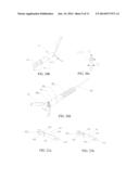 LIVING TISSUE LIGATION DEVICE diagram and image