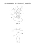 CLAMPING AND LIGATION DEVICE diagram and image