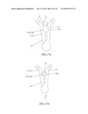 CLAMPING AND LIGATION DEVICE diagram and image