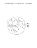 METHODS AND APPARTUS FOR CROSSING OCCLUSIONS IN BLOOD VESSELS diagram and image