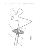 ASSEMBLY AND METHOD FOR LEFT ATRIAL APPENDAGE OCCLUSION diagram and image