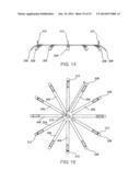 ASSEMBLY AND METHOD FOR LEFT ATRIAL APPENDAGE OCCLUSION diagram and image