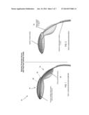 SYSTEM FOR FACILITATING TRANSCATHETER AORTIC VALVE PROCEDURES USING     FEMORAL ACCESS diagram and image