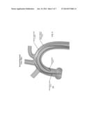 SYSTEM FOR FACILITATING TRANSCATHETER AORTIC VALVE PROCEDURES USING     FEMORAL ACCESS diagram and image