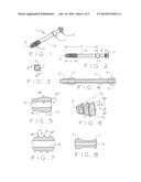 MINIMAL INCISION REMOVABLE BONE SCREW, DRIVER, AND METHOD OF USE diagram and image