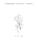 MINIMAL INCISION REMOVABLE BONE SCREW, DRIVER, AND METHOD OF USE diagram and image