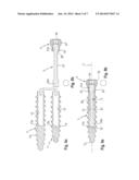 DYNAMIC BONE ANCHOR AND METHOD OF MANUFACTURING THE SAME diagram and image