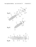 DYNAMIC BONE ANCHOR AND METHOD OF MANUFACTURING THE SAME diagram and image