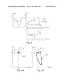 ACTIVE IMPLANTABLE MEDICAL DEVICE TYPE SUCH AS A PACEMAKER WITH DETECTION     OF ANODAL STIMULATION BY ANALYSIS OF A VECTOGRAM diagram and image