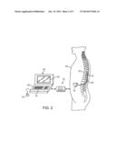 COMPUTATIONALLY EFFICIENT TECHNIQUE FOR DETERMINING ELECTRODE CURRENT     DISTRIBUTION FROM A VIRTUAL MULTIPOLE diagram and image