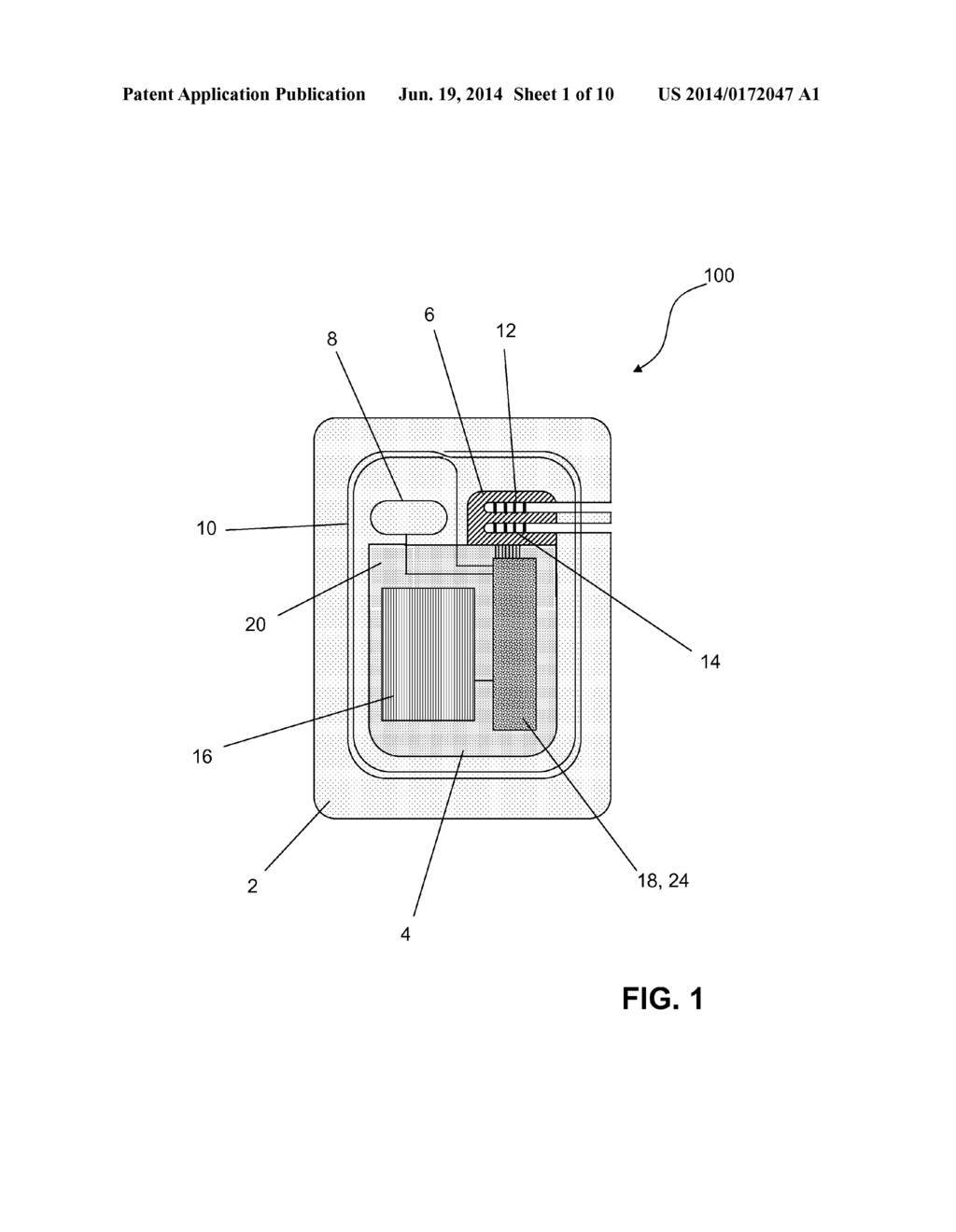 IMPLANTABLE PULSE GENERATOR FOR STIMULATION OF A NEUROLOGICAL CELLULAR     MASS - diagram, schematic, and image 02