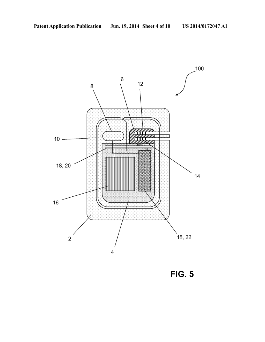 IMPLANTABLE PULSE GENERATOR FOR STIMULATION OF A NEUROLOGICAL CELLULAR     MASS - diagram, schematic, and image 05