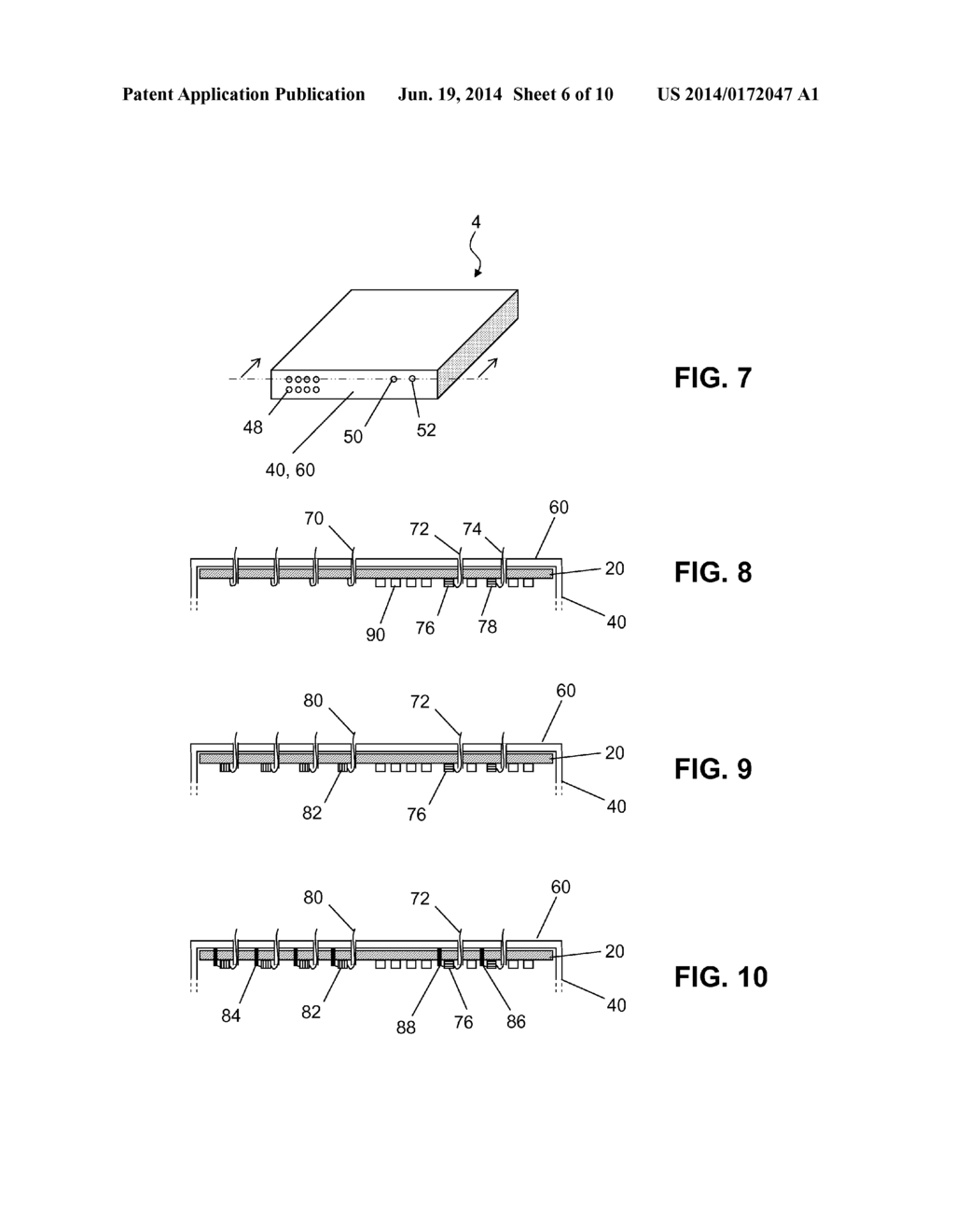 IMPLANTABLE PULSE GENERATOR FOR STIMULATION OF A NEUROLOGICAL CELLULAR     MASS - diagram, schematic, and image 07