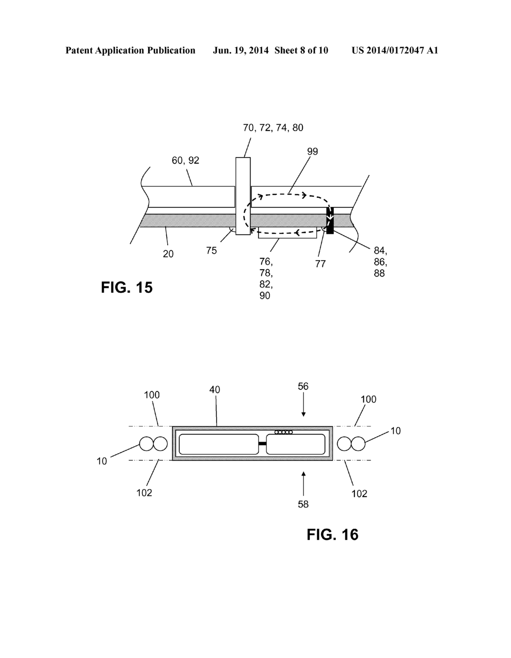 IMPLANTABLE PULSE GENERATOR FOR STIMULATION OF A NEUROLOGICAL CELLULAR     MASS - diagram, schematic, and image 09