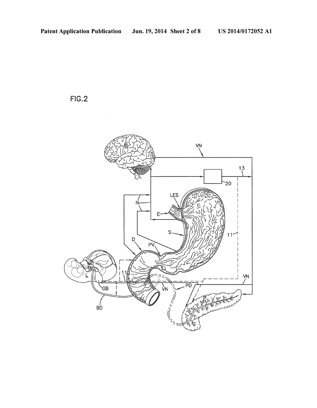 NERVE STIMULATION AND BLOCKING FOR TREATMENT OF GASTROINTESTINAL DISORDERS - diagram, schematic, and image 03