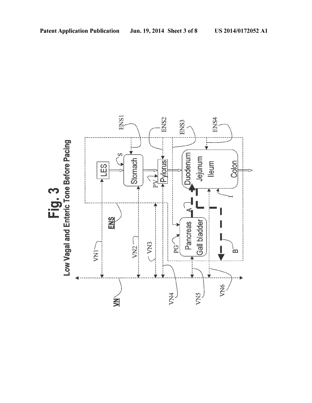 NERVE STIMULATION AND BLOCKING FOR TREATMENT OF GASTROINTESTINAL DISORDERS - diagram, schematic, and image 04