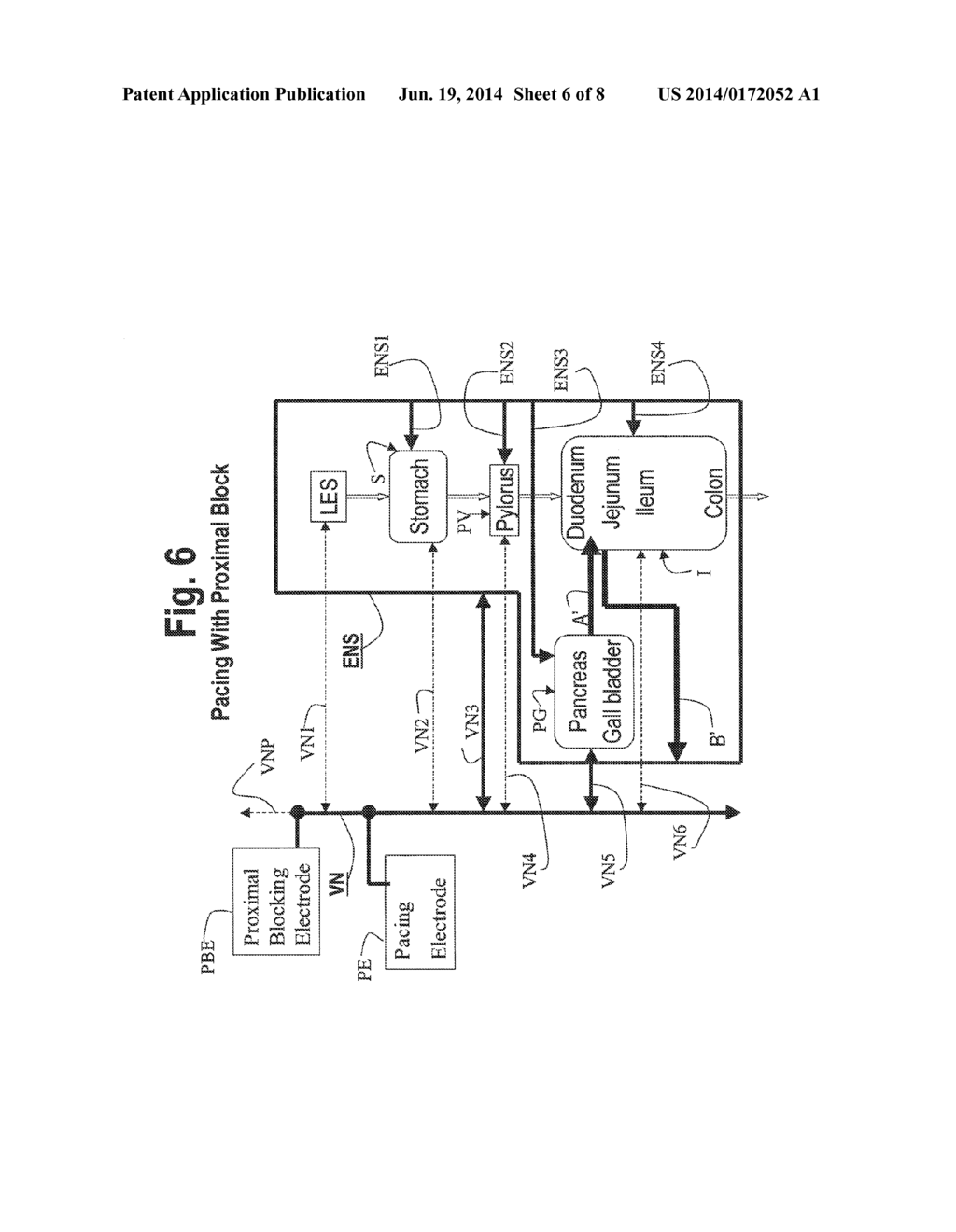NERVE STIMULATION AND BLOCKING FOR TREATMENT OF GASTROINTESTINAL DISORDERS - diagram, schematic, and image 07