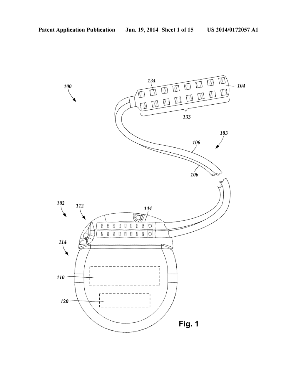 SYSTEMS AND METHODS FOR MAKING AND USING PADDLE LEADS OF ELECTRICAL     STIMULATION SYSTEMS - diagram, schematic, and image 02