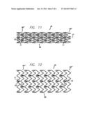 DRUG-ELUTING STENT AND DELIVERY SYSTEM WITH TAPERED STENT IN SHOULDER     REGION diagram and image