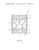 MULTI-FRAME PROSTHETIC HEART VALVE diagram and image