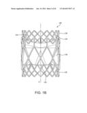 MULTI-FRAME PROSTHETIC HEART VALVE diagram and image