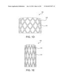 MULTI-FRAME PROSTHETIC HEART VALVE diagram and image