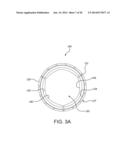 MULTI-FRAME PROSTHETIC HEART VALVE diagram and image