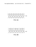 MULTI-FRAME PROSTHETIC HEART VALVE diagram and image