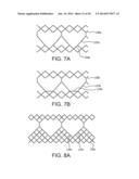 MULTI-FRAME PROSTHETIC HEART VALVE diagram and image