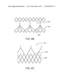 MULTI-FRAME PROSTHETIC HEART VALVE diagram and image