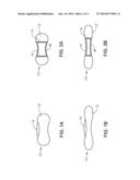 PRESBYOPIA-CORRECTING IOL USING CURVATURE CHANGE OF AN AIR CHAMBER diagram and image