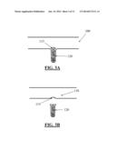 SOLID FREEFORM FABRICATION OF IMPLANT COMPONENTS diagram and image