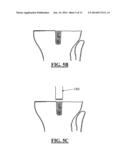 SOLID FREEFORM FABRICATION OF IMPLANT COMPONENTS diagram and image