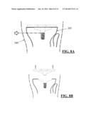 SOLID FREEFORM FABRICATION OF IMPLANT COMPONENTS diagram and image