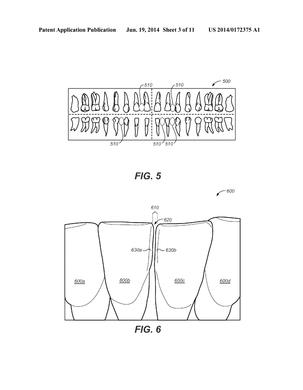 CREATING A DIGITAL DENTAL MODEL OF A PATIENT'S TEETH USING INTERPROXIMAL     INFORMATION - diagram, schematic, and image 04