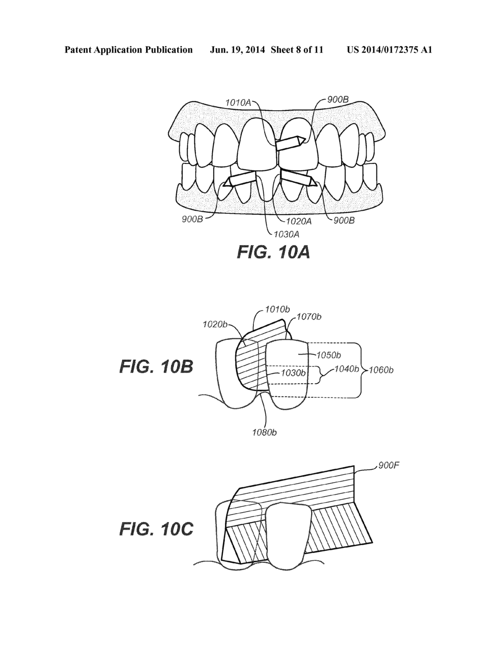 CREATING A DIGITAL DENTAL MODEL OF A PATIENT'S TEETH USING INTERPROXIMAL     INFORMATION - diagram, schematic, and image 09