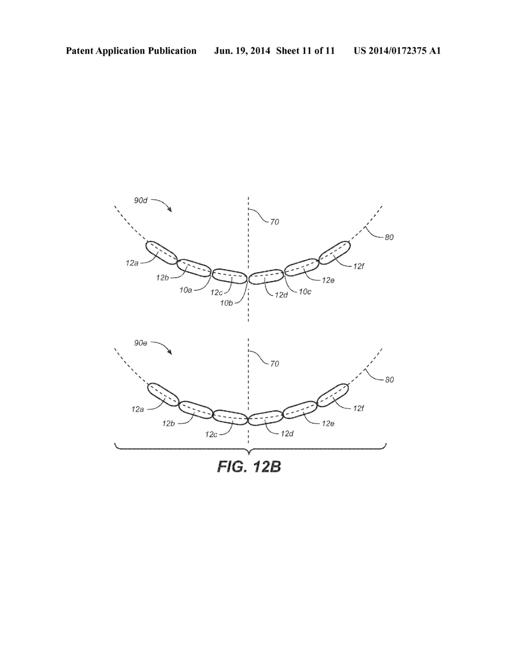 CREATING A DIGITAL DENTAL MODEL OF A PATIENT'S TEETH USING INTERPROXIMAL     INFORMATION - diagram, schematic, and image 12