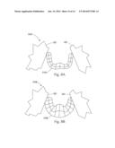 METHOD FOR MODELING AN EXUDATE ON A SUBSTRATE diagram and image