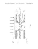 IMPACT REDUCTION SYSTEM diagram and image